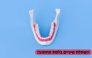 השתלת שיניים בלסת תחתונה